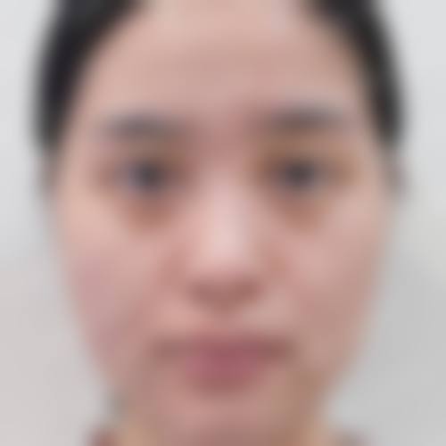 临床实例分享