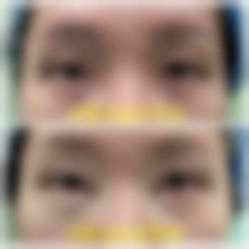 优惠活动详情