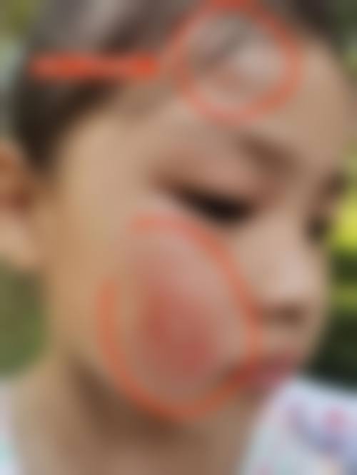眼科检查与手术项目价格表
