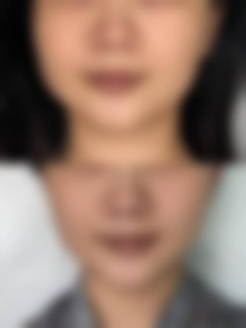 项目价格透明与优惠详情