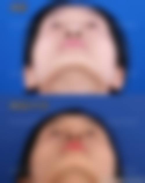 价格与优惠活动:高性价比实现塑美心愿