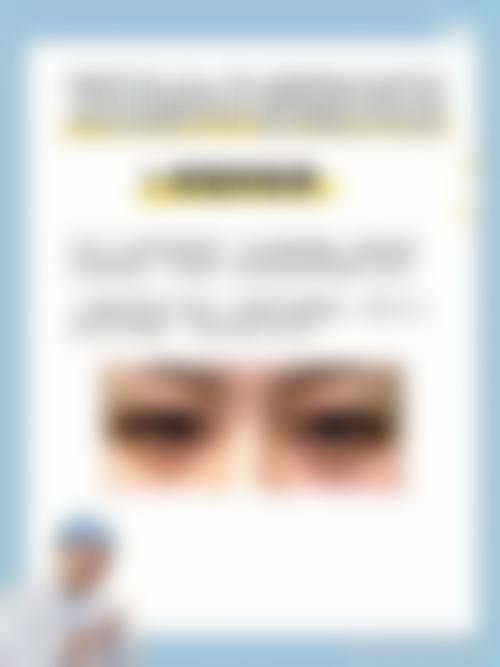 临床实例分享