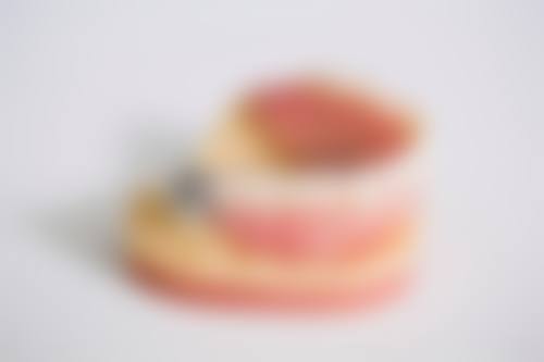 特色科室与项目:从洗牙到种植,一站式解决