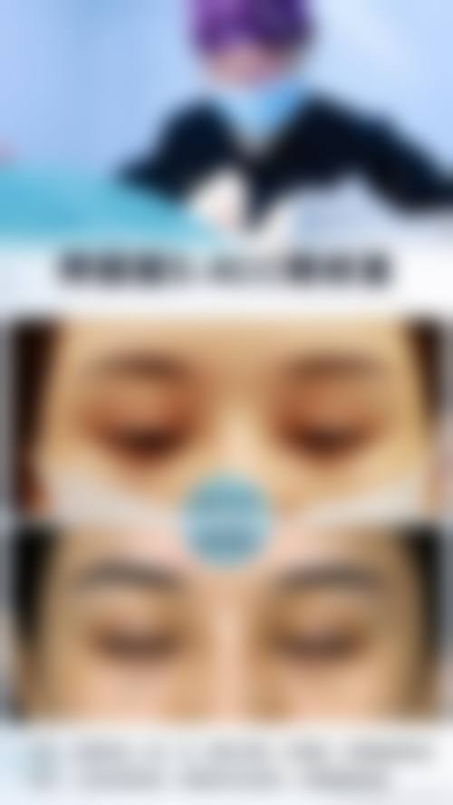 常见问题解答