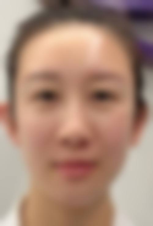服务流程:从询问到术后全程贴心