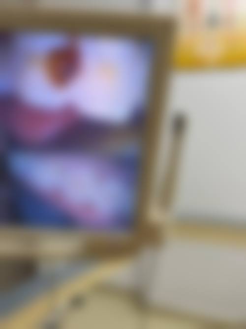 北京中日友好医院王鹏飞医生技术特色