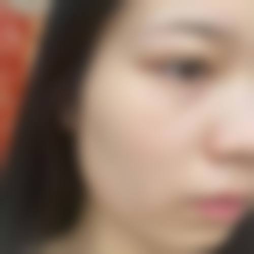 优惠活动详情:限时放送,让美丽触手可及