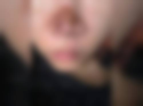 设备与环境:无菌手术室+前列仪器,提升诊疗成效