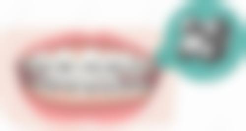 Q:种植牙能用多久?术后要注意什么?