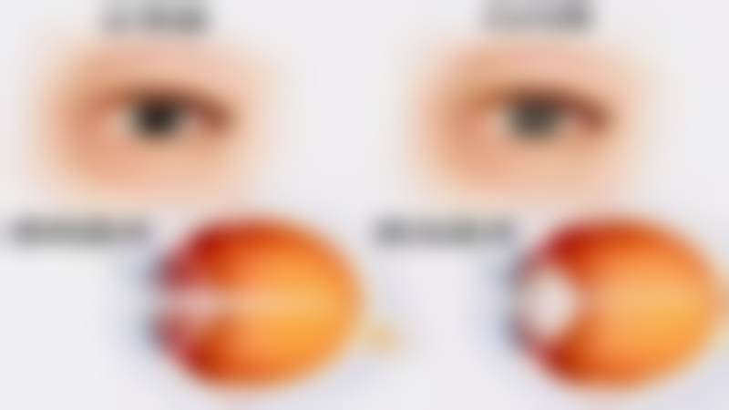 临床实例分享