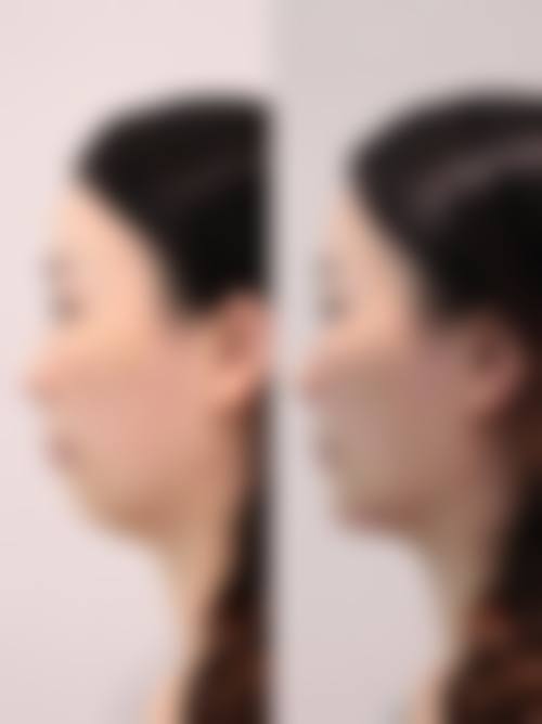 优惠活动详情:高性价比,限时预约