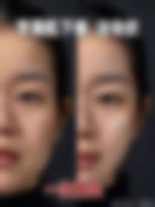 优惠活动详情:美丽无需高昂代价