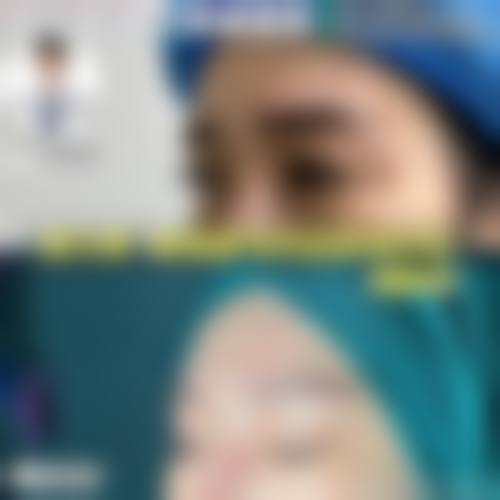 优惠活动详情:高性价比医美选择