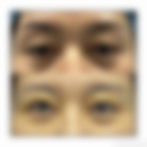 优惠活动详情