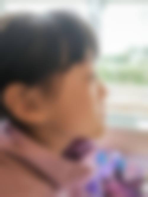 临床实例分享