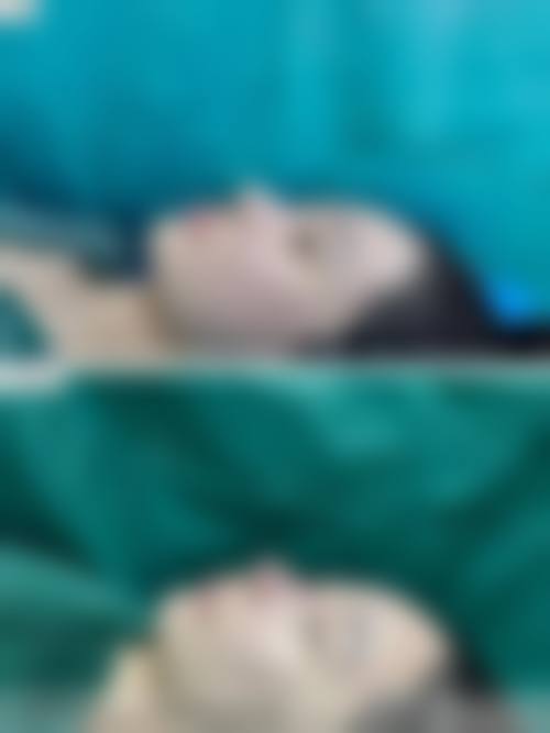 特色项目详解：面部整形与身体塑形