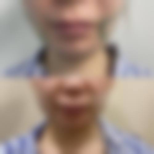结语：开启您的安心变得更美之旅