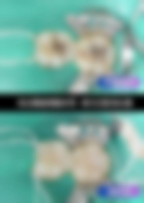 上海雅悦齿科闫阿强医生的收费价格表
