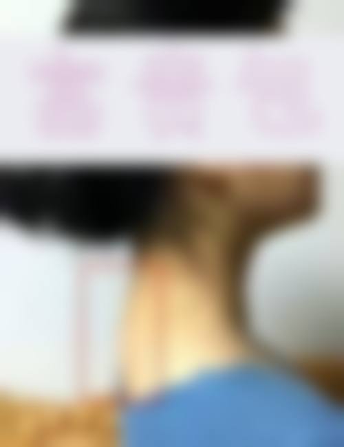优惠活动详情：面诊设计免费，疗程组合更划算