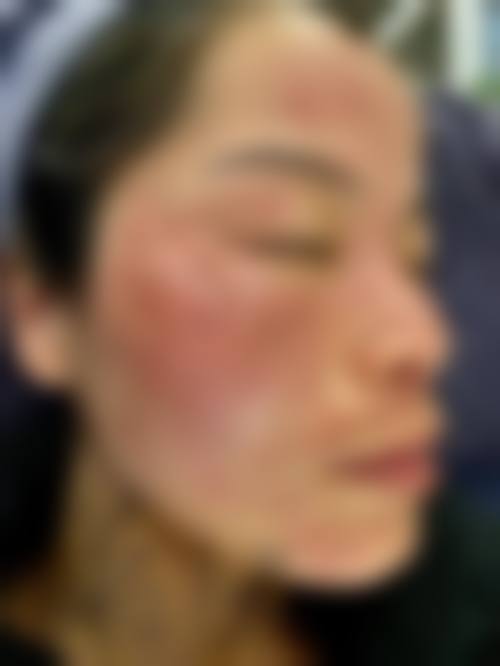 手术环境与设备保护