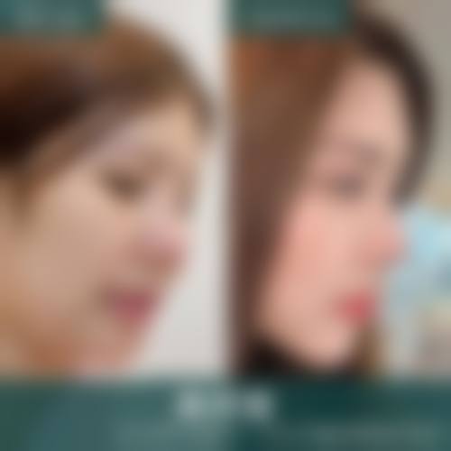 结尾：选择鸿嘉怡美，开启焕美之旅