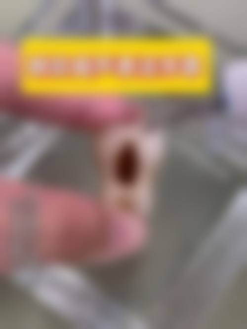 优惠活动详情：限时特别优惠，限名额预约