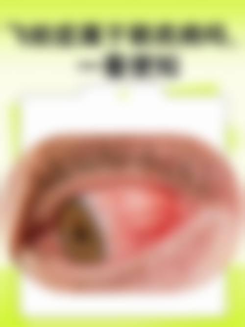 优惠活动详情