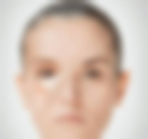 设备环境介绍：进口设备与层流手术室，确保手术精细安心