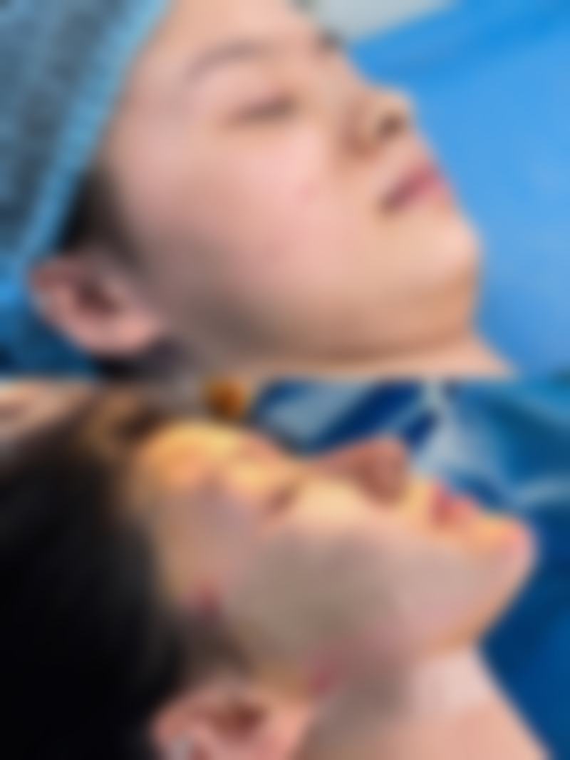 预约优惠活动
