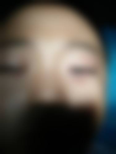 临床实例分享
