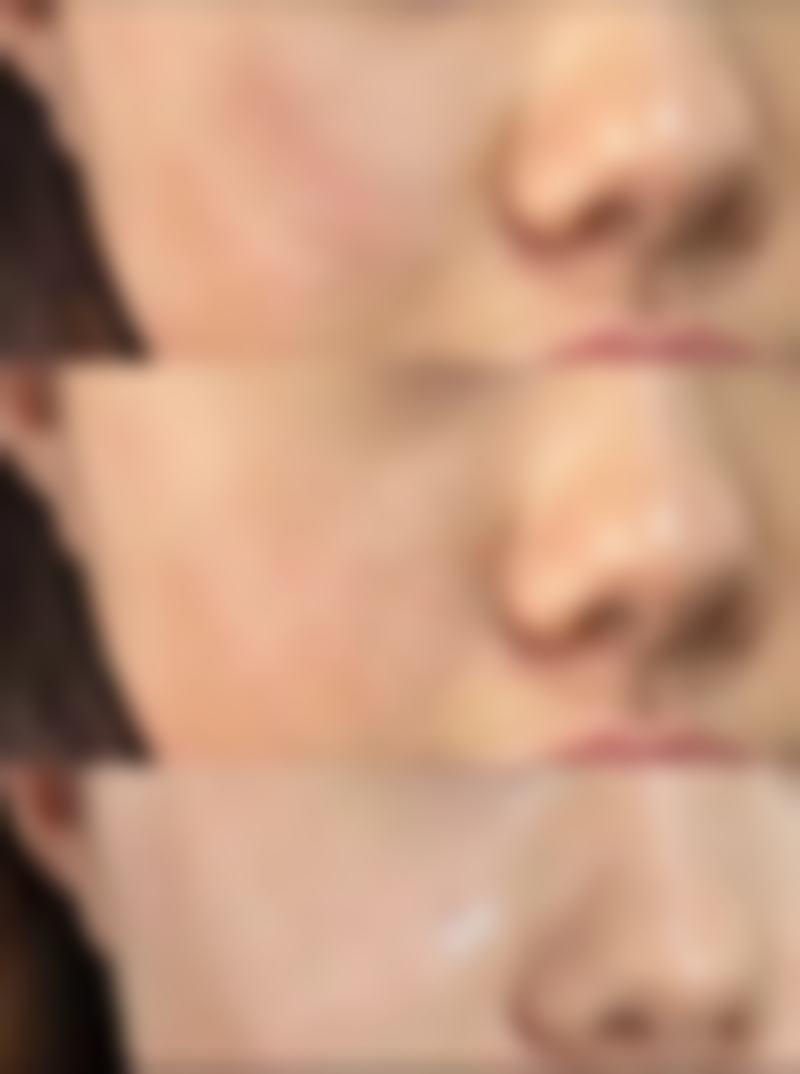 临床实例分享