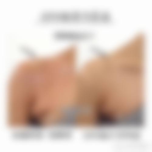 临床实例分享