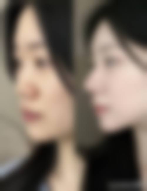 优惠活动详情