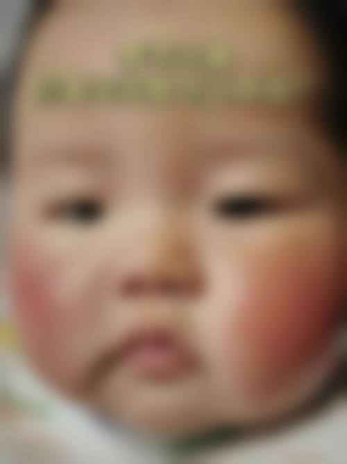 临床实例分享