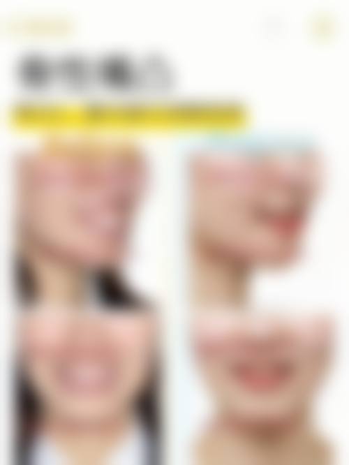 优惠活动详情:限时补贴,轻松看牙