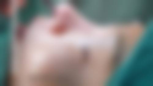 临床实例分享