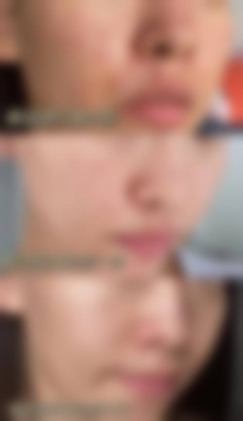 服务流程与患者保护:个性化方案与全程跟进
