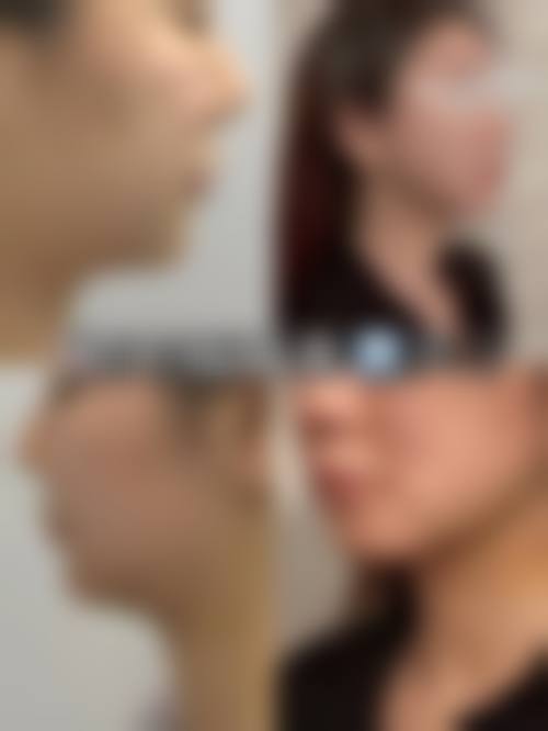 擅长项目详解(赣州华兴整形医院刘兴洲)