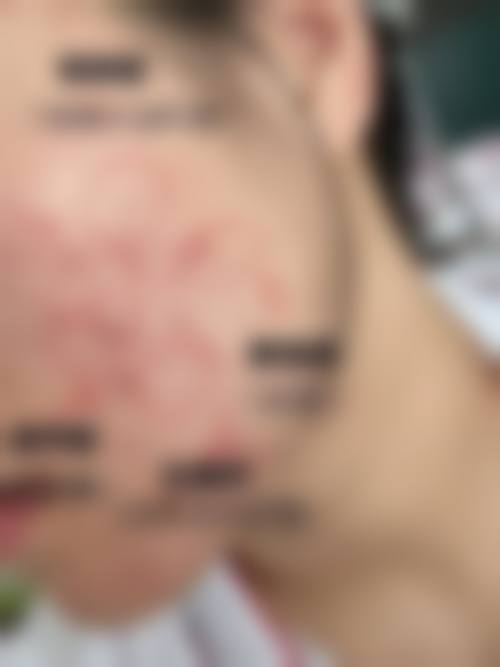 擅长项目详解
