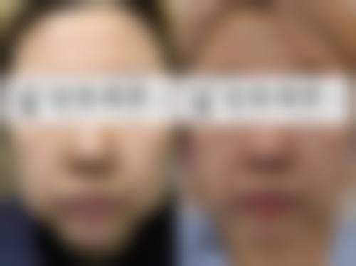 临床实例分享