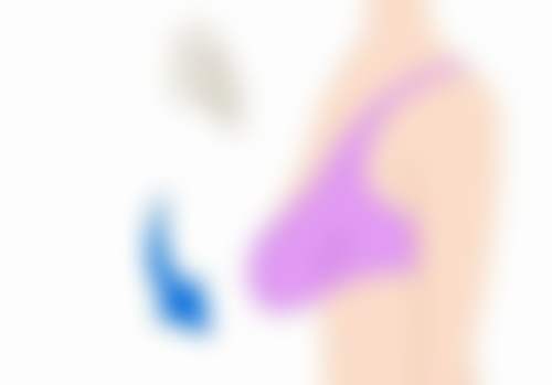 临床实例分享（张歌医生临床实例）