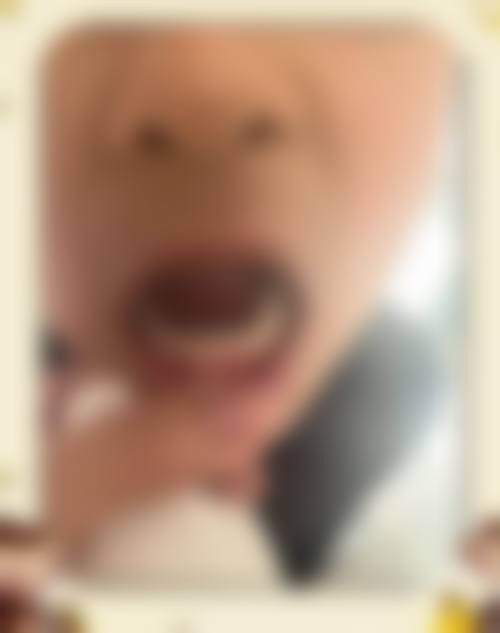 怀化市第一人民医院李铁华医生怎么预约挂号