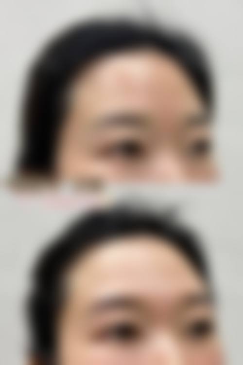特色植发项目与技术——个性化解决脱发问题