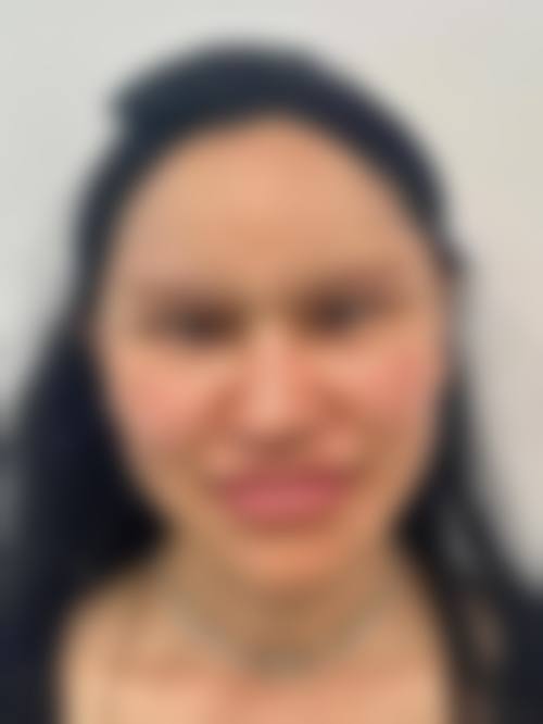特色医美项目与技术