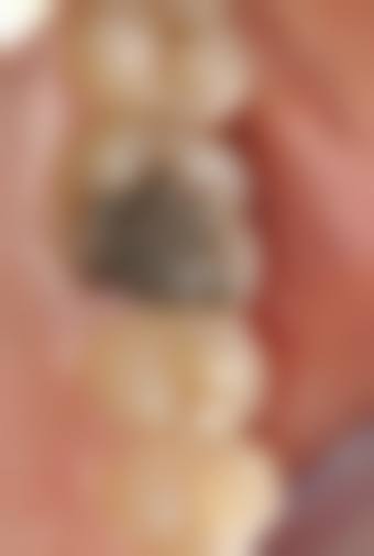 雅辰口腔吴红运医生技术特色