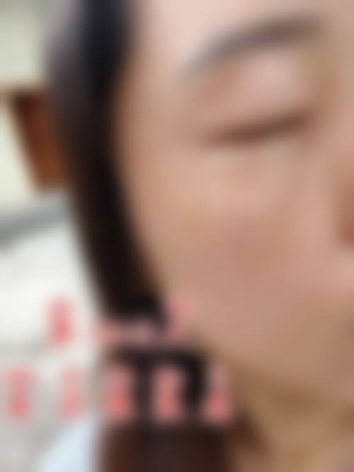 临床实例分享