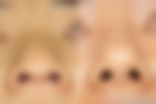 擅长项目详解