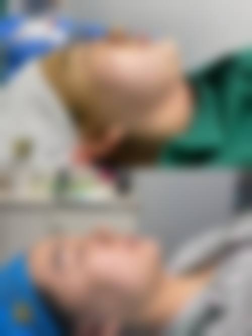 临床实例分享