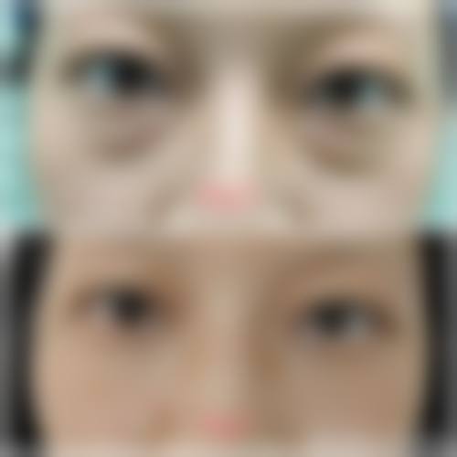 优惠活动详情